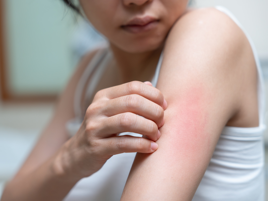 Banish Itchy Menopausal Skin with EaZential: Your Natural Solution